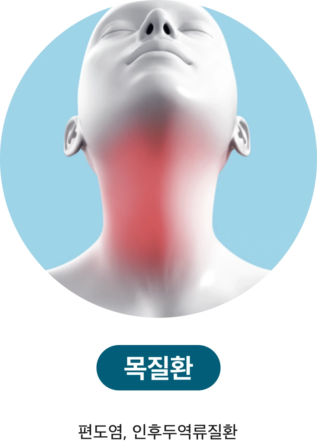 목질환: 편도염, 인후두역류질환
